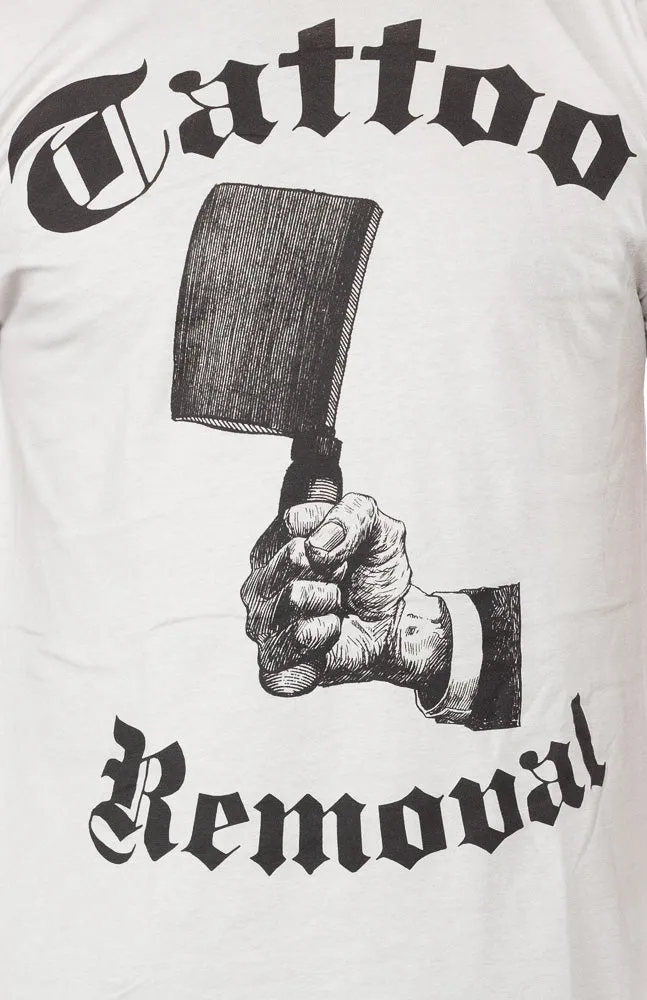 ANNEX TATTOO REMOVAL T SHIRT
